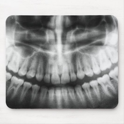X-Ray Teeth Mouth Smile Schwarz-Weiß Mousepad (Vorne)