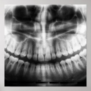 X-Ray Teeth Mouth Smile Schwarz-Weiß Poster