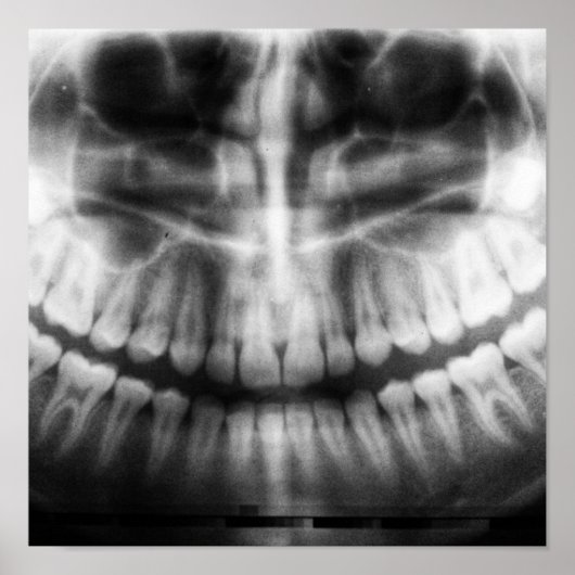 X-Ray Teeth Mouth Smile Schwarz-Weiß Poster (Vorne)