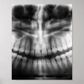 X-Ray Teeth Mouth Smile Schwarz-Weiß Poster (Vorne)