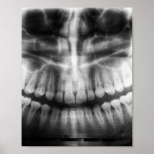 X-Ray Teeth Mouth Smile Schwarz-Weiß Poster