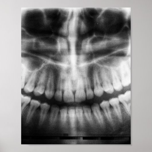 X-Ray Teeth Mouth Smile Schwarz-Weiß Poster (Vorne)