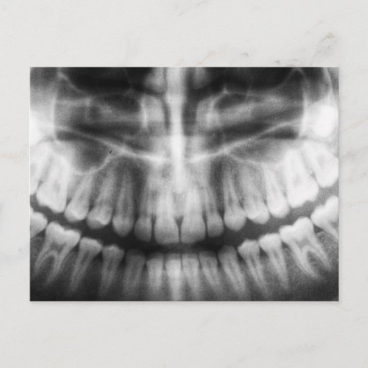 X-Ray Teeth Mouth Smile Schwarz-Weiß Postkarte (Vorderseite)