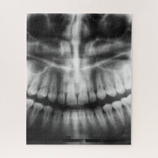 X-Ray Teeth Mouth Smile Schwarz-Weiß Puzzle (Vertikal)