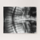 X-Ray Teeth Mouth Smile Schwarz-Weiß Puzzle (Horizontal)