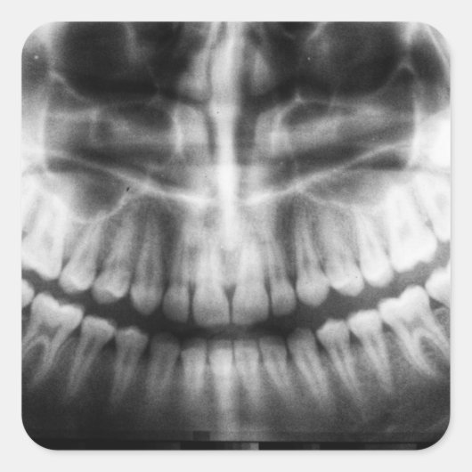 X-Ray Teeth Mouth Smile Schwarz-Weiß Quadratischer Aufkleber (Vorderseite)