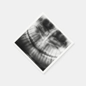 X-Ray Teeth Mouth Smile Schwarz-Weiß Serviette (Ecke)