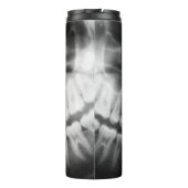 X-Ray Teeth Mouth Smile Schwarz-Weiß Thermosbecher (Rückseite)