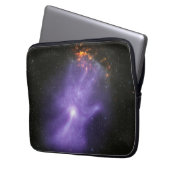 X-Ray Teleskope galant kosmische Hand Laptopschutzhülle (Vorderseite Links)