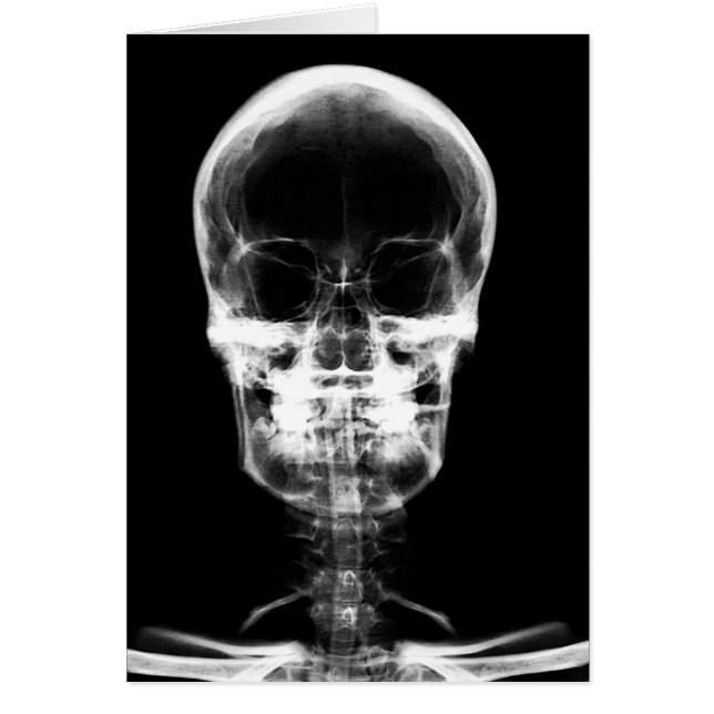 X-RAY VISION SKELETON SKULL - B&W (Vorne)