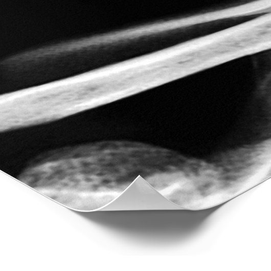 X-RAY VISION SKELETON SKULL - B&W POSTER (Ecke)