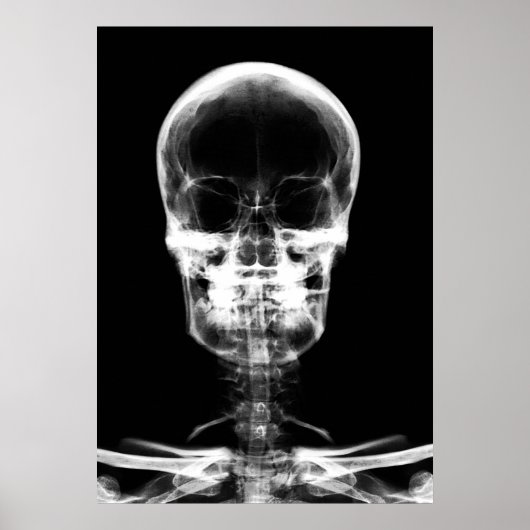 X-RAY VISION SKELETON SKULL - B&W POSTER (Vorne)