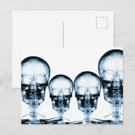 X-Ray Vision Skeleton Skull - Blue Postkarte (Vorne/Hinten)