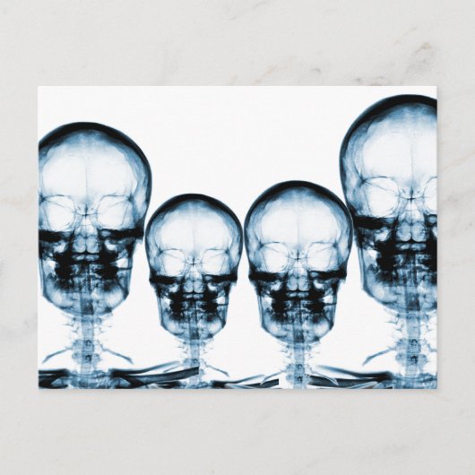 X-Ray Vision Skeleton Skull - Blue Postkarte (Vorderseite)