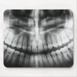 X-Ray Zähne Mouth Smile Schwarz und Weiß Mousepad