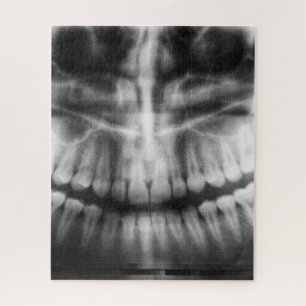 X-Ray Zähne Mouth Smile Schwarz und Weiß Puzzle