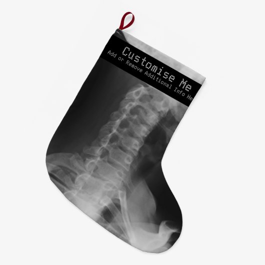 X-Rayed 2 (Original) Großer Weihnachtsstrumpf (Vorderansicht (hängend))