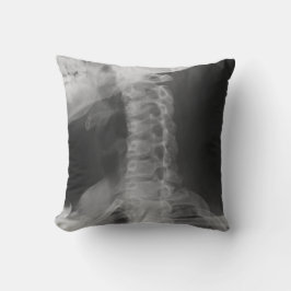 X-Rayed 2 (Original) Kissen