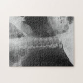 X-Rayed 2 (Original) Puzzle (Horizontal)