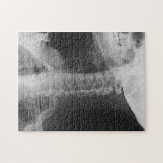 X-Rayed 2 (Original) Puzzle (Horizontal)