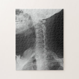 X-Rayed 2 (Original) Puzzle