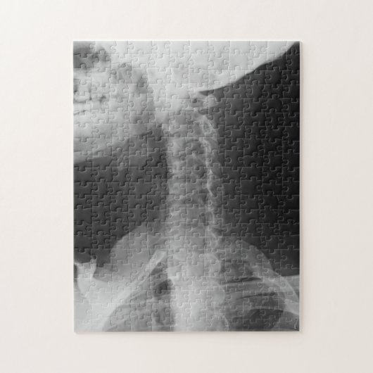 X-Rayed 2 (Original) Puzzle (Vertikal)