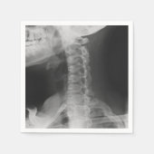 X-Rayed 2 (Original) Serviette (Vorderseite)