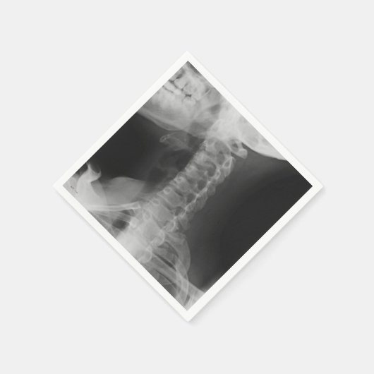 X-Rayed 2 (Original) Serviette (Ecke)