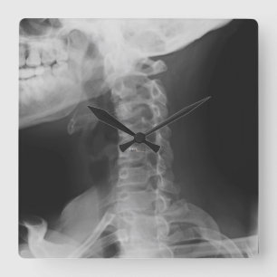 X-rayed 2 quadratische wanduhr
