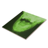 X-Rayed 3 - Radioaktiv Green Fliese (Seite)