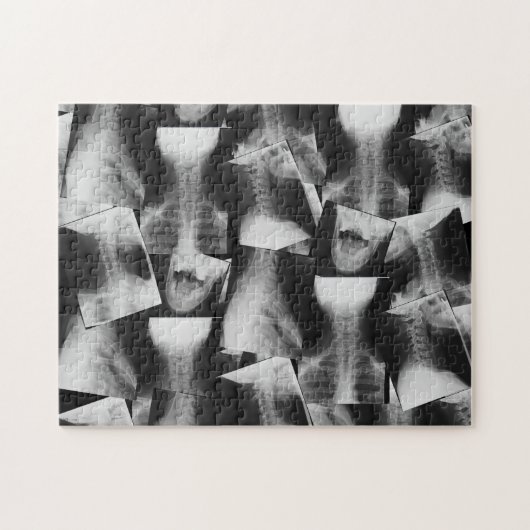 X-Rayed (Original) Puzzle (Horizontal)