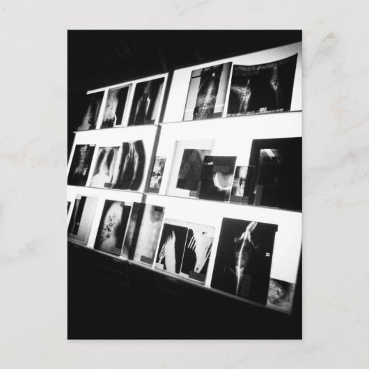 X-Rays Postkarte (Vorderseite)