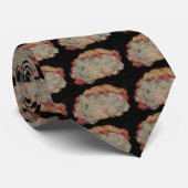 Xanthogranulomatous Pyelonephritis Krawatte (Gerollt)