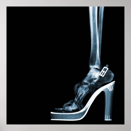 XRAY HEEL LADY SKELETON FOOT BLUE POSTER (Vorne)