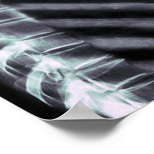 XRAY SKELETON DRILL ORIGINALE FARBEN POSTER (Ecke)