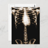 XRAY SKELETON TORSO RIBS SEPIA POSTKARTE (Vorne/Hinten)