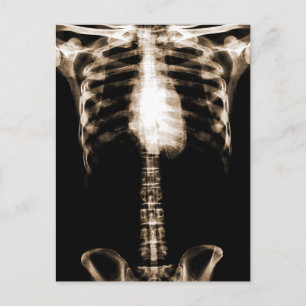 XRAY SKELETON TORSO RIBS SEPIA POSTKARTE