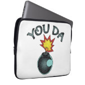 You Da Glitzer Bomb Laptopschutzhülle (Vorne Rechts)