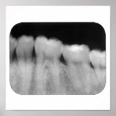 Zähne mit Füllung Poster (Vorne)