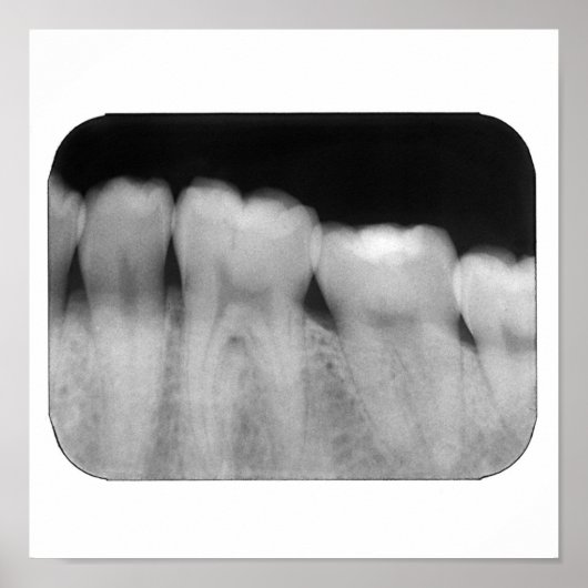 Zähne mit Füllung Poster (Vorne)
