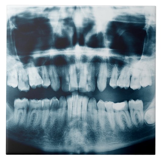 Zähne Röntgenaufnahme Fliese (Vorderseite)