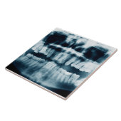 Zähne Röntgenaufnahme Fliese (Seite)