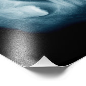 Zähne Röntgenaufnahme Fotodruck (Ecke)