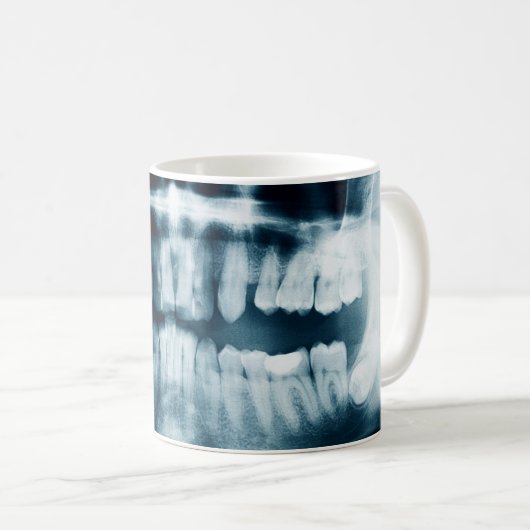 Zähne Röntgenaufnahme Kaffeetasse (VorderseiteRechts)