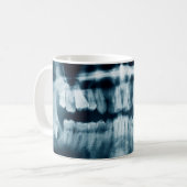 Zähne Röntgenaufnahme Kaffeetasse (Vorderseite Links)