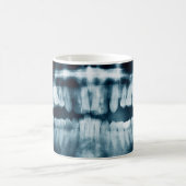 Zähne Röntgenaufnahme Kaffeetasse (Mittel)