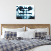 Zähne Röntgenaufnahme Leinwanddruck (Insitu (Schlafzimmer))