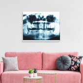 Zähne Röntgenaufnahme Leinwanddruck (Insitu (Wohnzimmer))