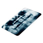 Zähne Röntgenaufnahme Magnet (Linke Seite)