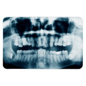 Zähne Röntgenaufnahme Magnet (Horizontal)